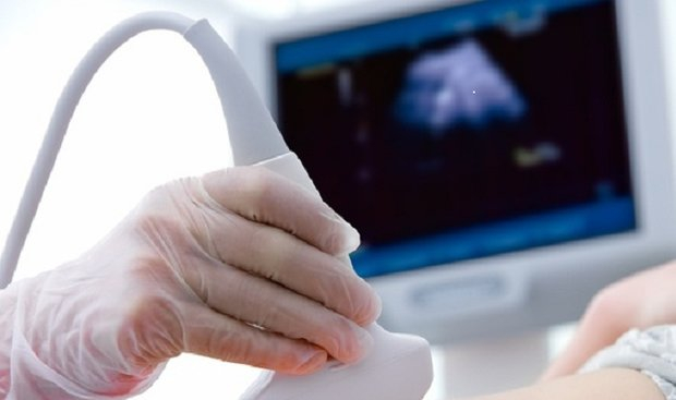 شناسایی برخی بیماری‌ها با سونوگرافی جنین