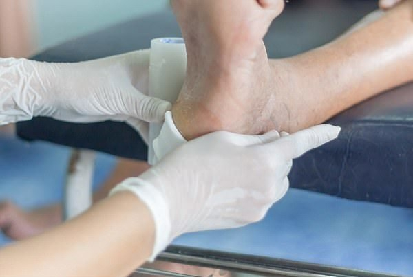 به کارگیری روش بومی ترمیم زخم پای دیابتی با «لارو» مگس