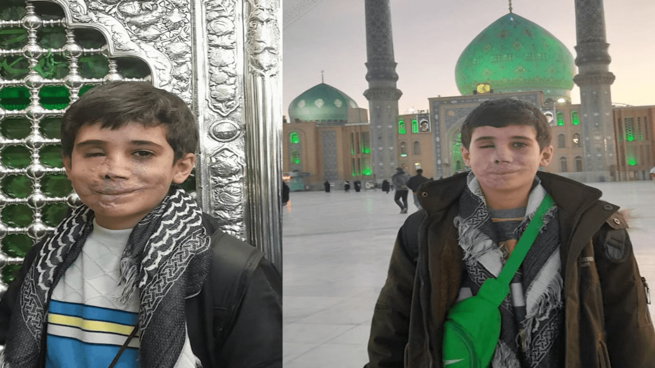 سرباز کوچکی که چشم و صورتش را داد، اما تسلیم نشد