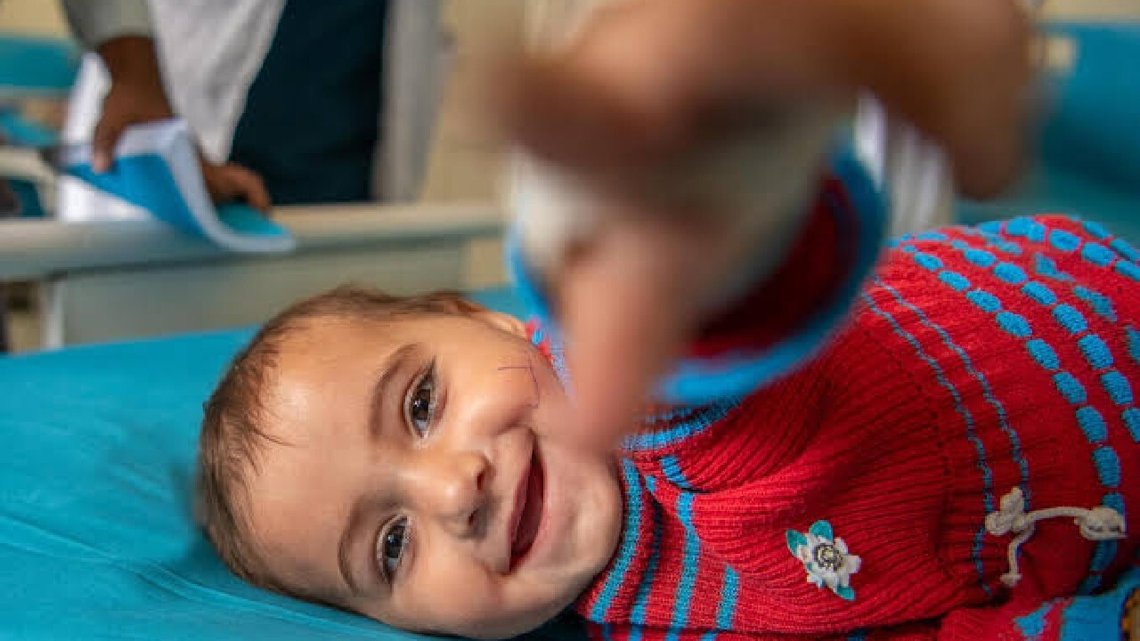 درمان ۴۸۰ هزار کودک مبتلا به سوءتغذیه شدید در افغانستان