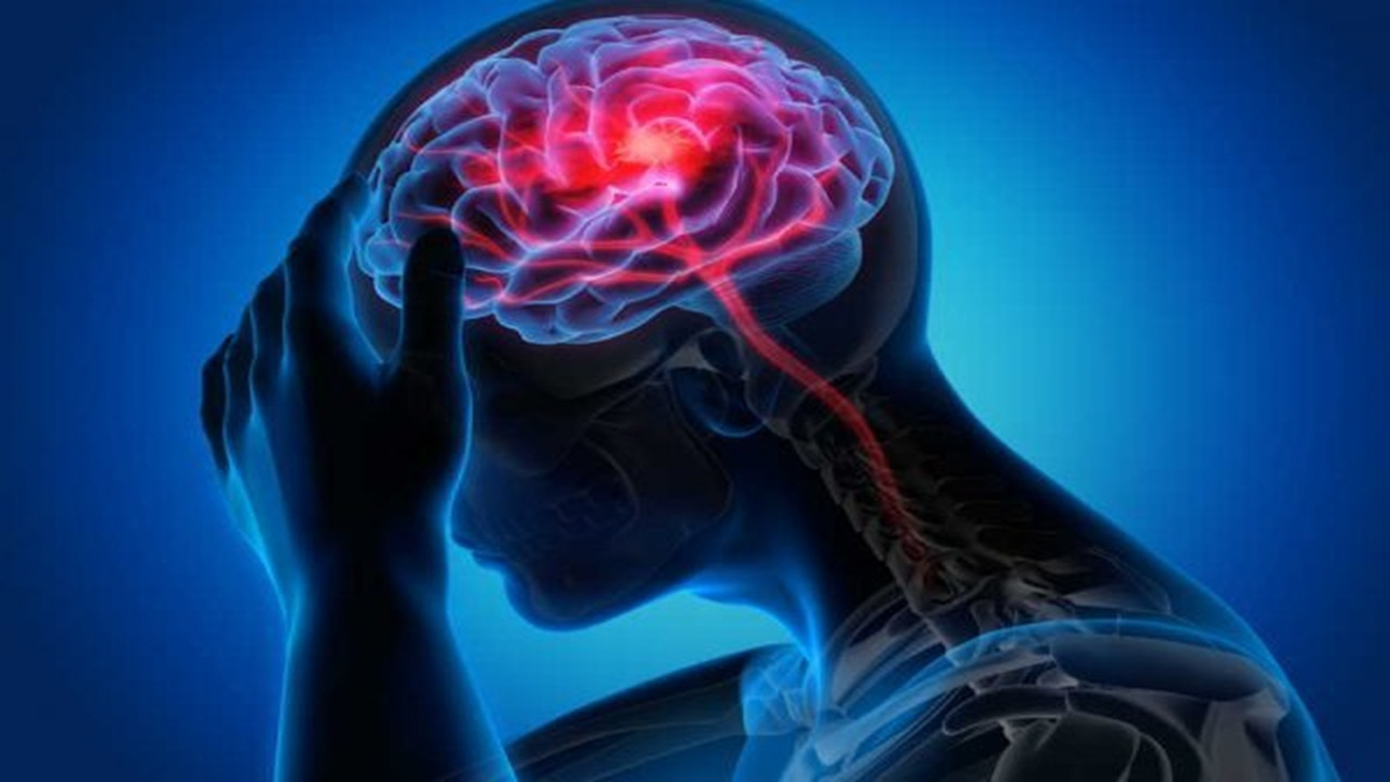 تفاوت سکته ایسکمیک و خونریزی و علائم سکته مغزی + فیلم