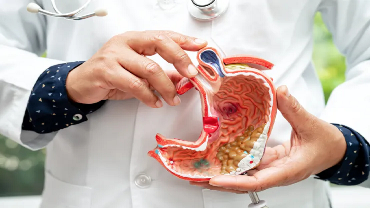 مصرف زیاد نمک؛ عاملی برای ابتلا به سرطان معده + فیلم