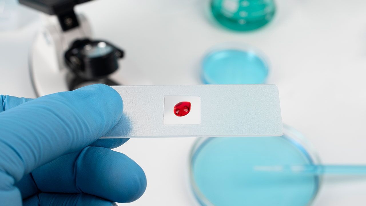 کمبود ست پیوند مغز استخوان نداریم