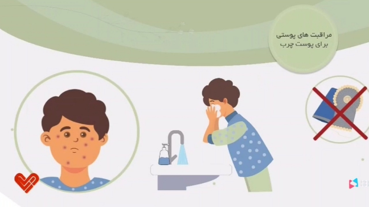 چگونه از پوست مراقبت کنیم؟ + فیلم