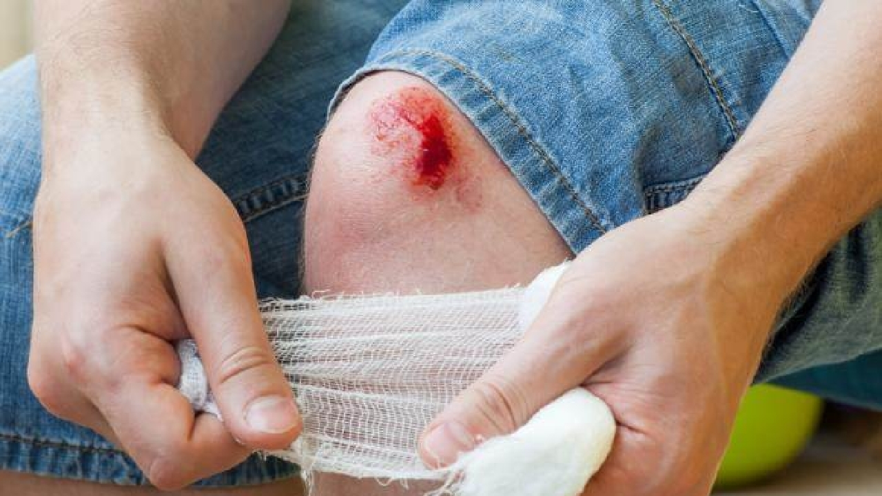 چرا زخمهای کوچک را نباید نادیده گرفت؟