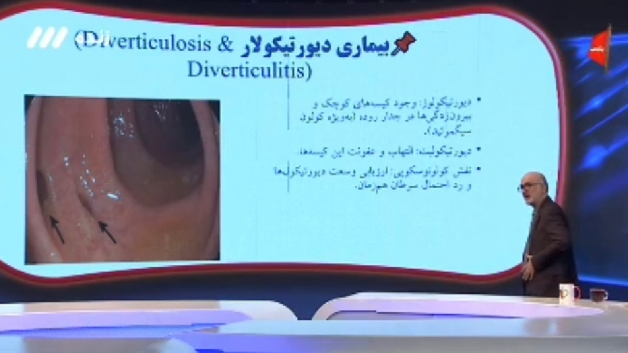 علت درد‌های شدید روده در بیمار + فیلم