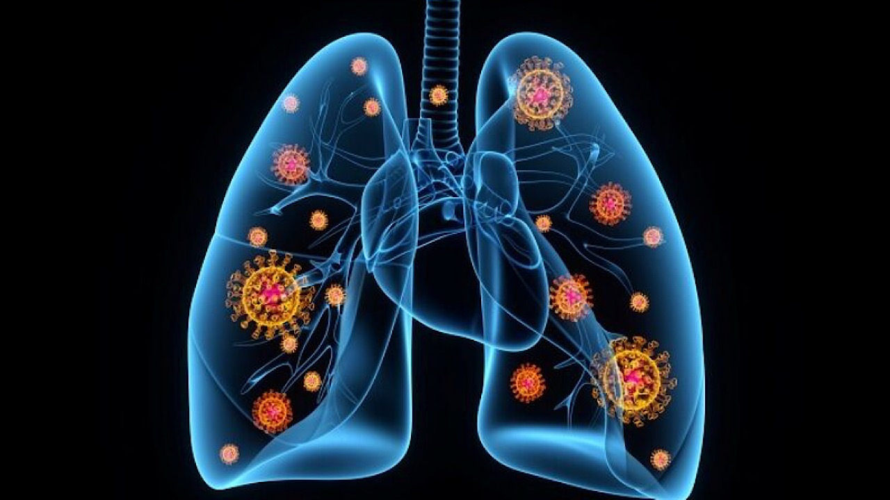 ذات‌الریه یک تهدید جدی برای کودکان و سالمندان است