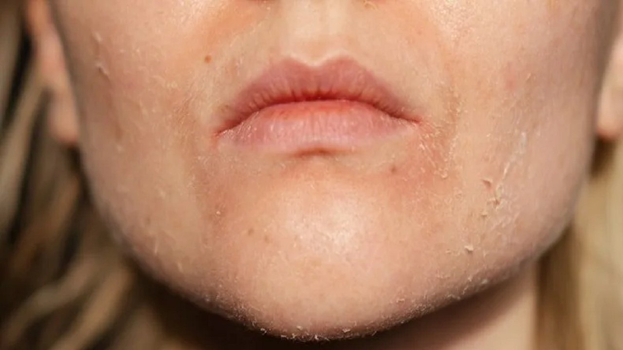 عادات و بیماریهای مرتبط با خشکی پوست