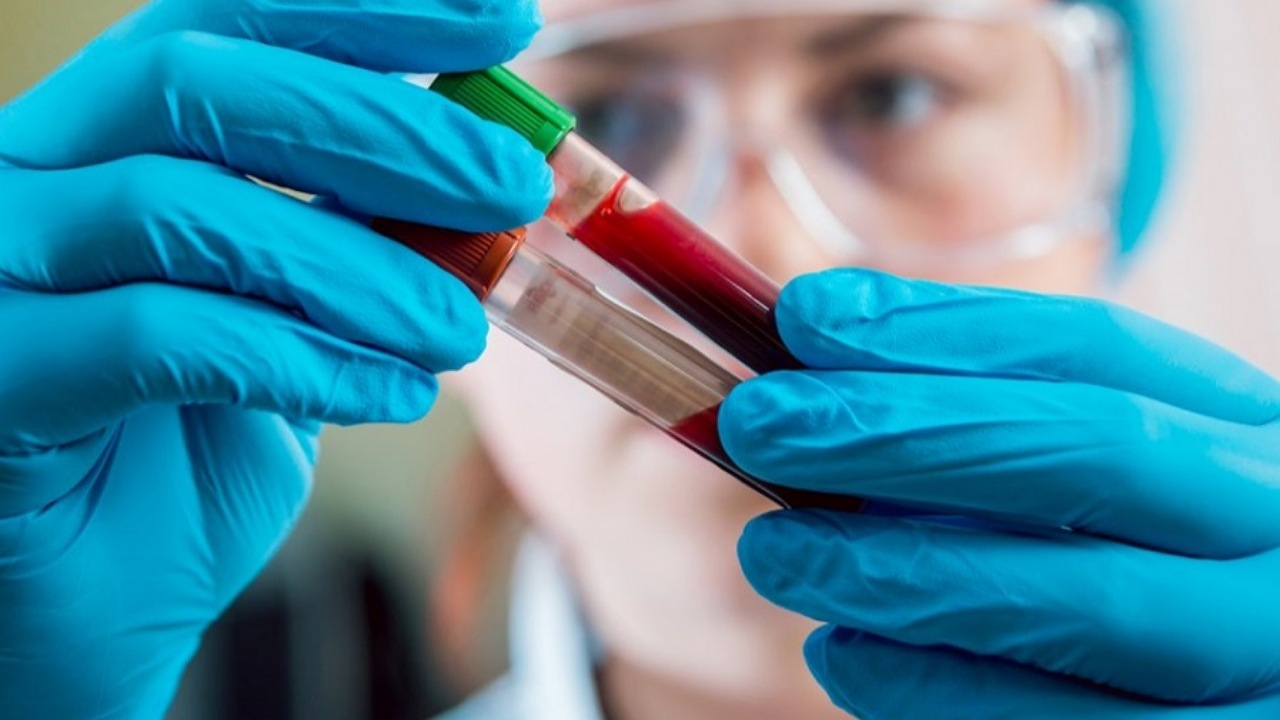 علائمی که ممکن است با کمخونی اشتباه گرفته شود + فیلم