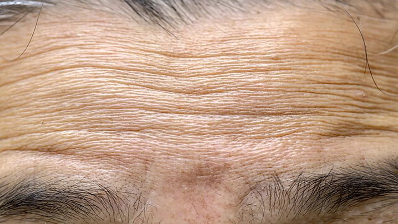 ترکیب فناوری نانو و زیست‌فناوری برای جوان‌سازی طبیعی و ماندگار پوست