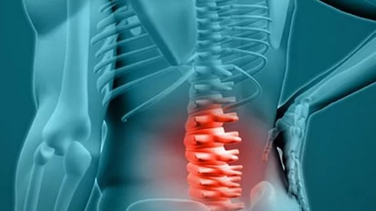 عوامل موثر در ابتلا به دیسک کمر کدامند؟
