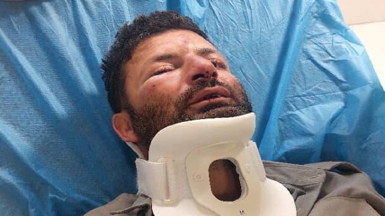 دومین حمله به حافظان طبیعت در شمیرانات؛ این بار ضرب و شتم یک محیط بان