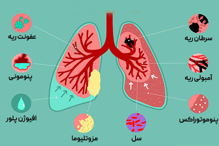 راهنمای نوبت دهی دکتر مسجدی متخصص ریه