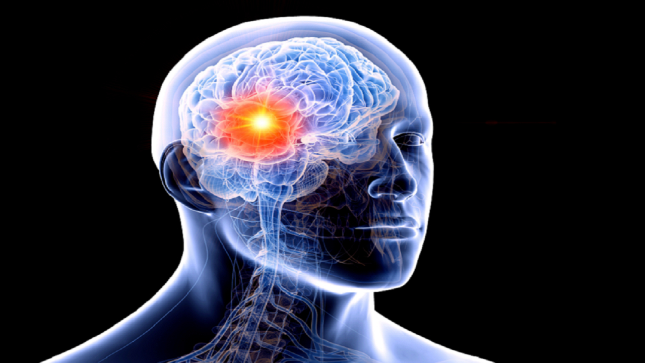 رویکردی جدید برای درمان یکی از خطرناکترین تومورهای مغزی