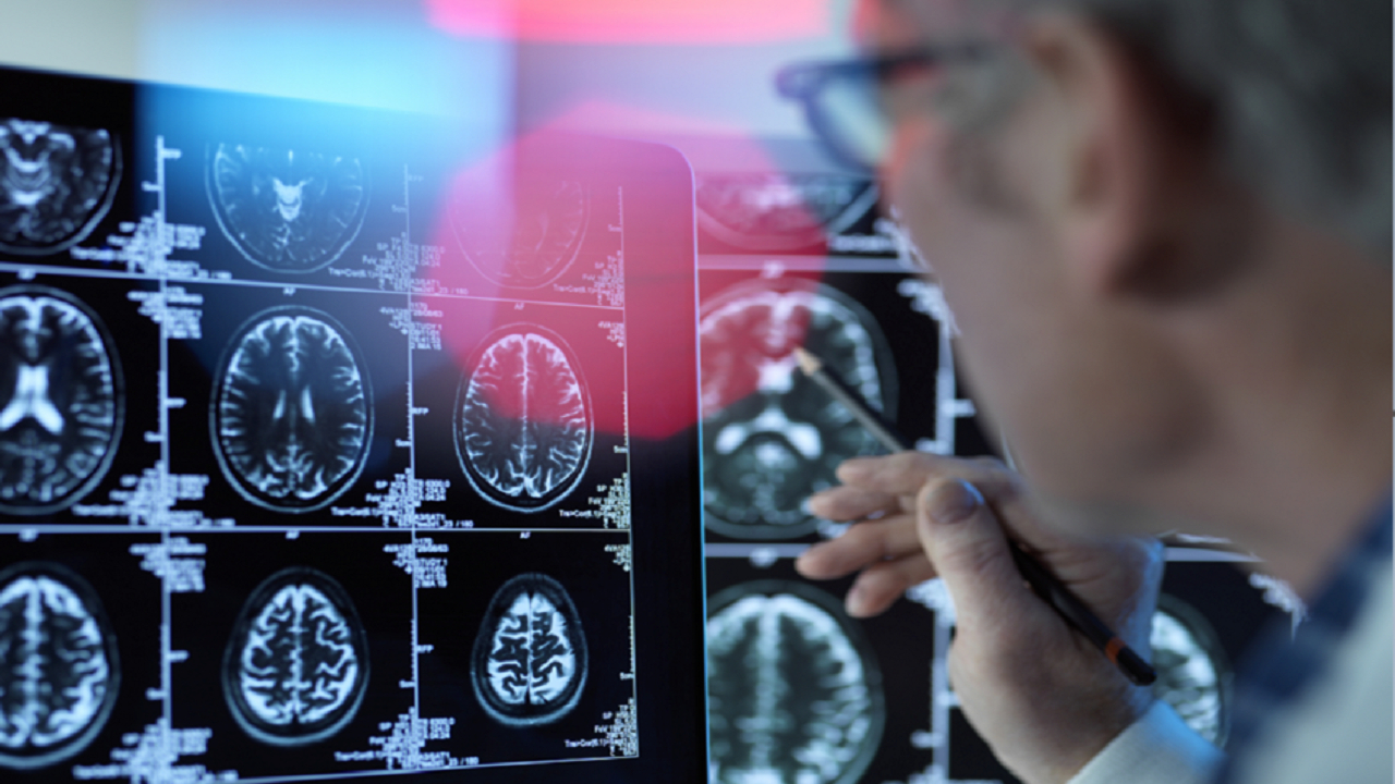 علامت‌های هشدار دهنده در میانسالی برای زوال عقل در مراحل بعدی 