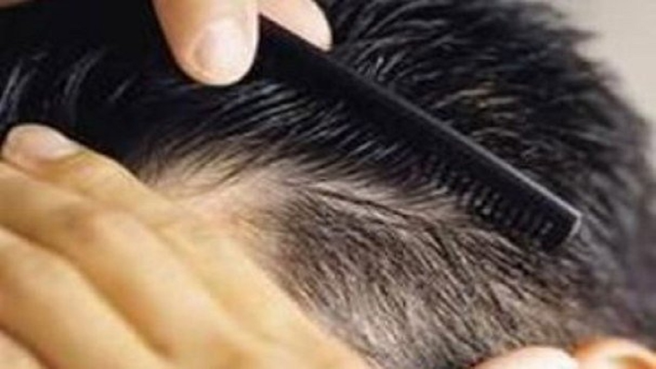 راهکار‌های طب ایرانی برای تقویت مو