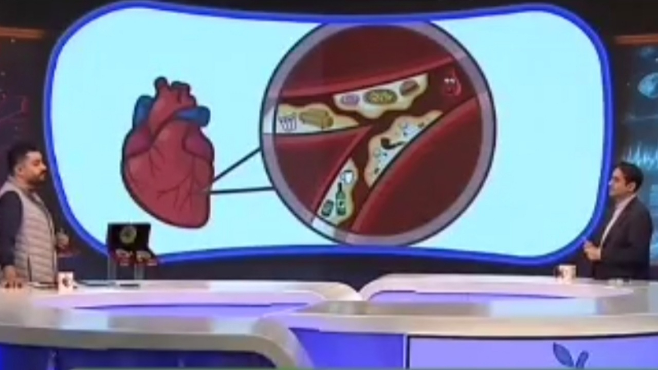 علائم چربی خون بالا + فیلم