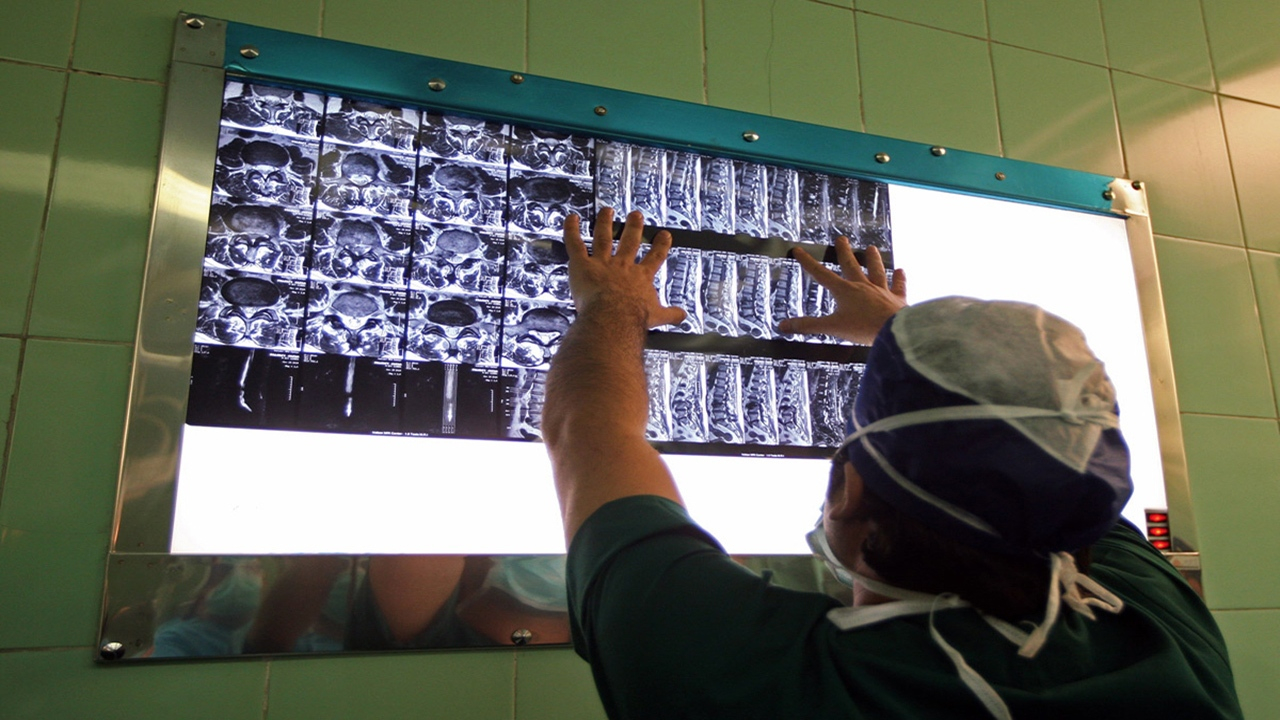 بیش از ۸۰ درصد بیماریهای ستون فقرات نیاز به عمل جراحی ندارد